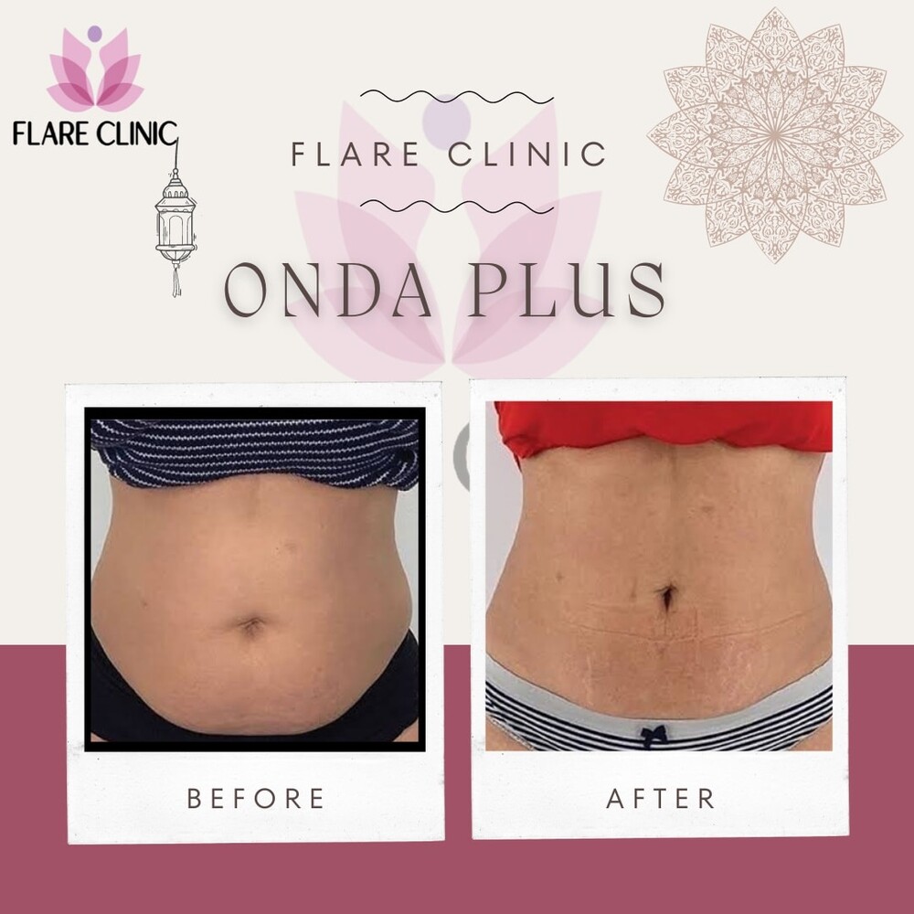 Before and After Result